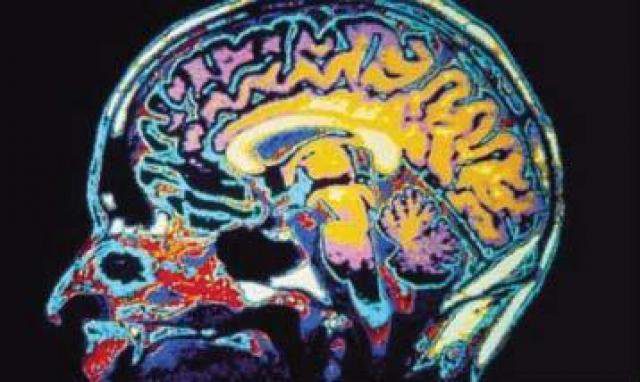 Нейропластичность и нейрогенез: является ли каннабис ноотропом, который улучшает работу мозга?